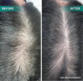 before after 2