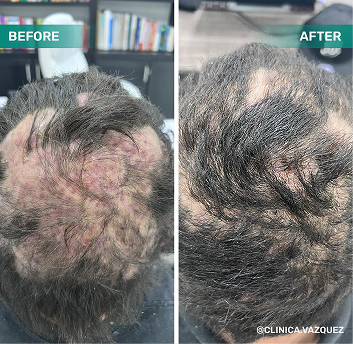 before after 3